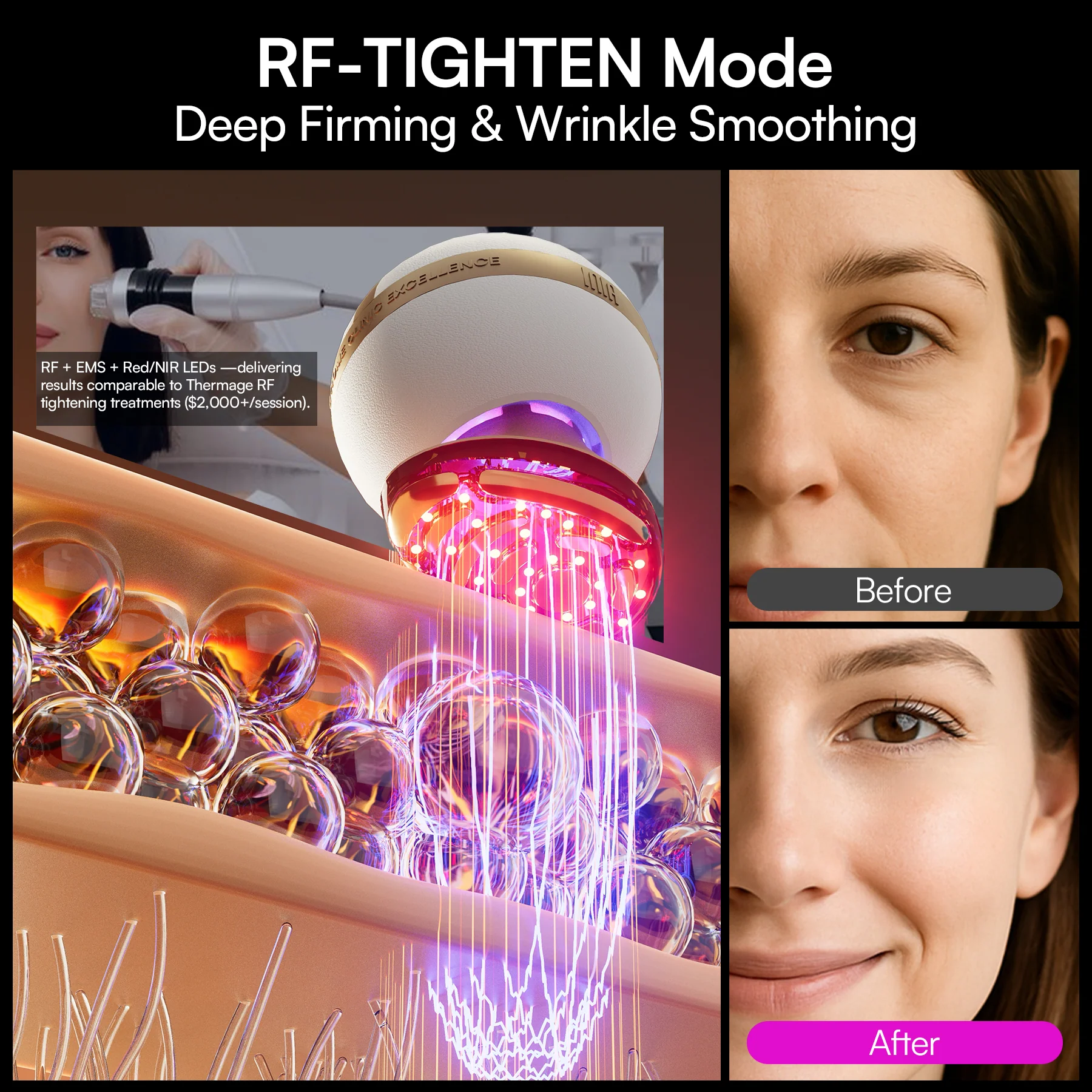 INIA SPHERA At-Home Clinical-Grade RF, EMS & LED Rejuvenation Device - Image 5