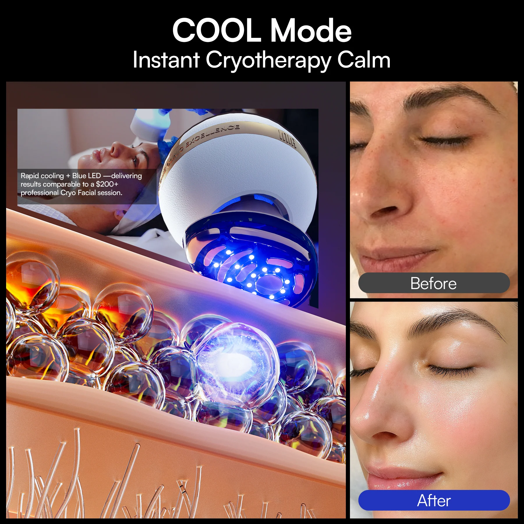 INIA SPHERA At-Home Clinical-Grade RF, EMS & LED Rejuvenation Device - Image 7