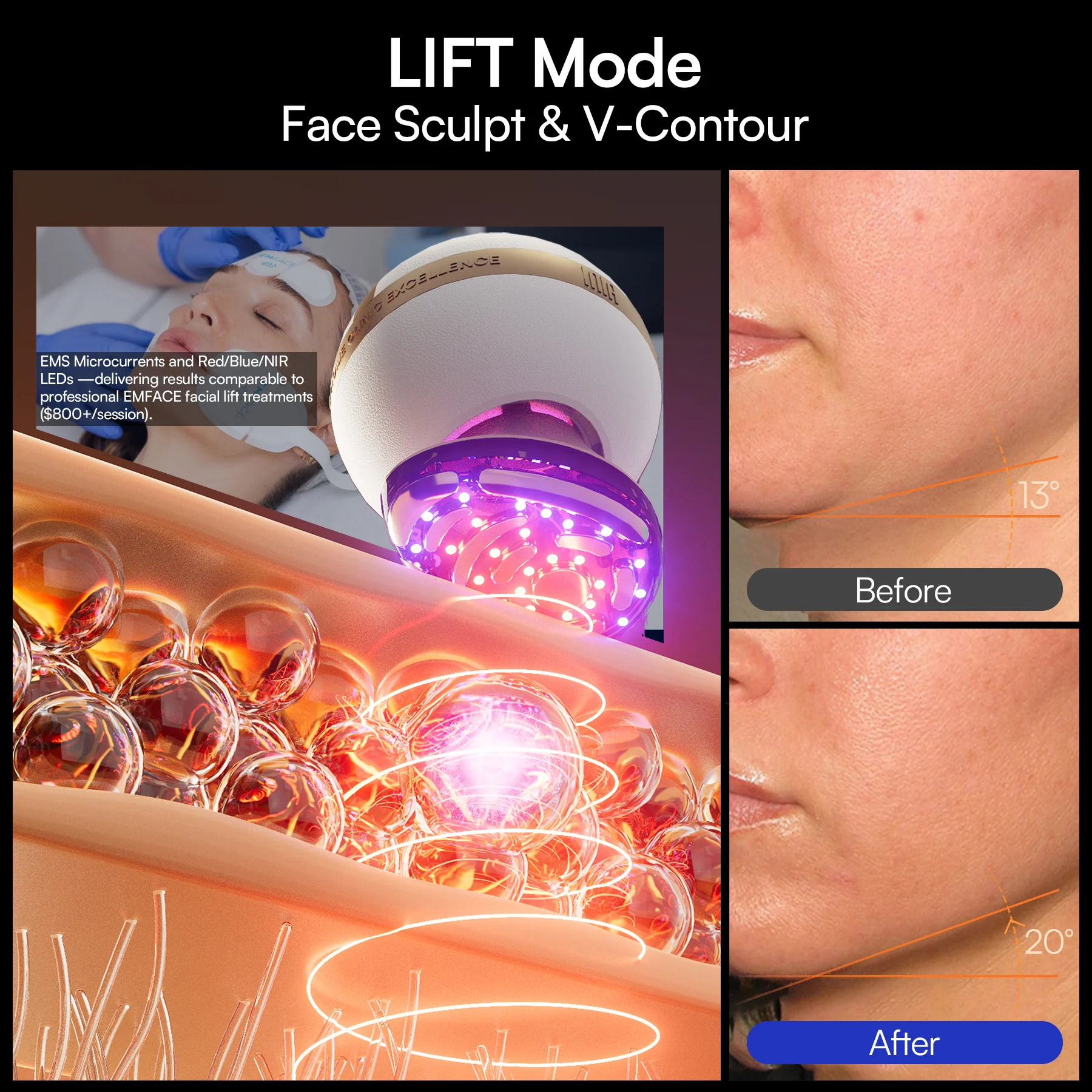 INIA SPHERA At-Home Clinical-Grade RF, EMS & LED Rejuvenation Device - Image 8