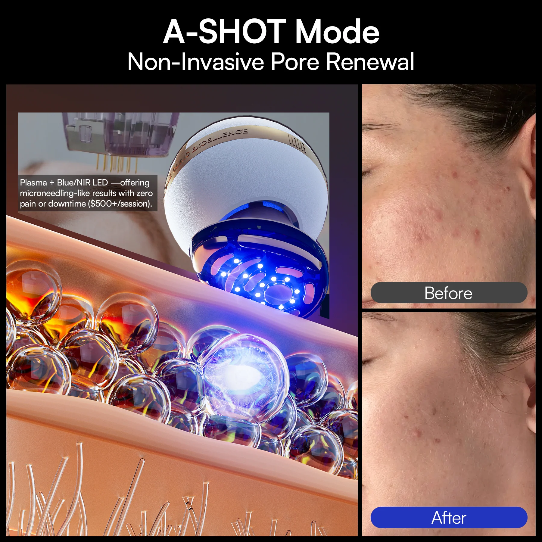INIA SPHERA At-Home Clinical-Grade RF, EMS & LED Rejuvenation Device - Image 9