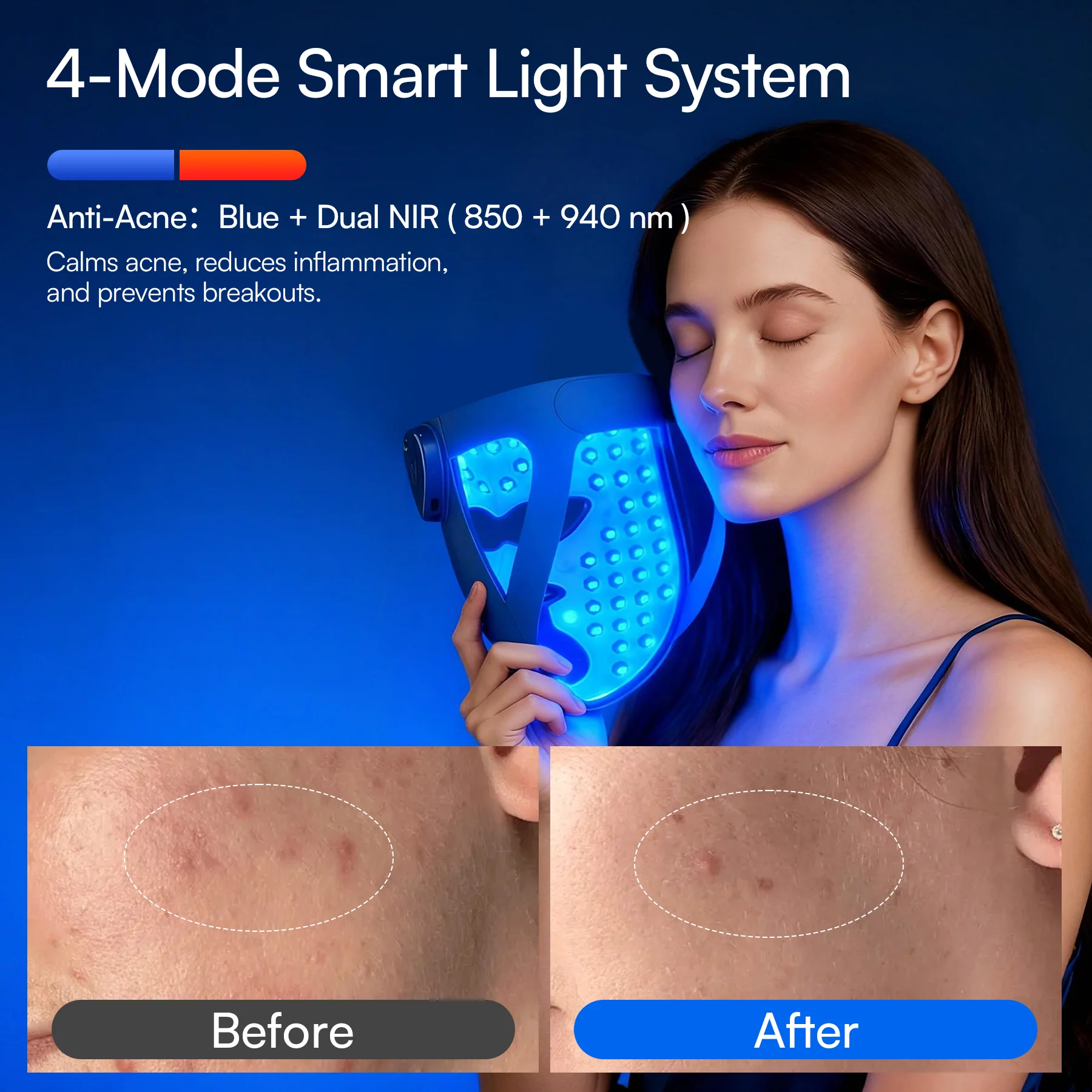 INIA GLOW 4D 940nm Dual NIR Wireless LED Mask - Image 5