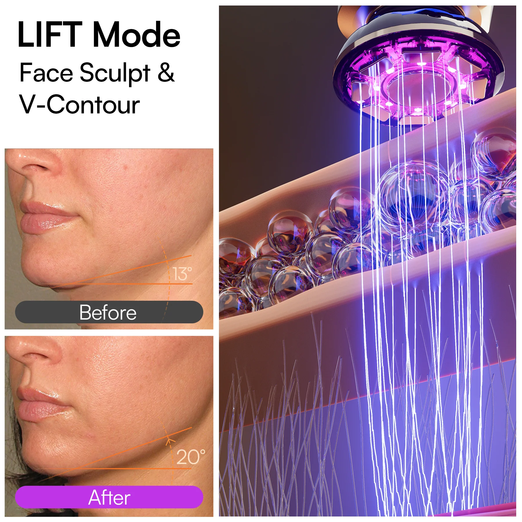 INIA FLARE Microcurrent Facial Device - Image 4
