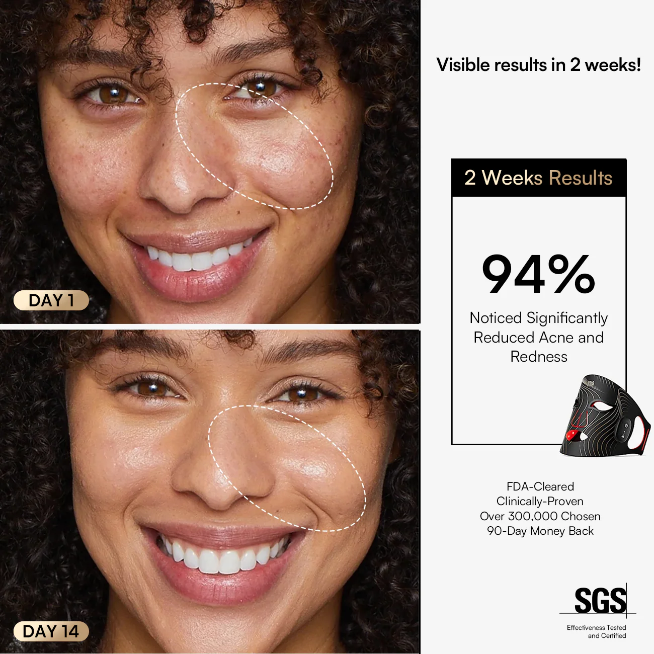 INIA GLOW Wireless Red Light Therapy Mask - Image 4