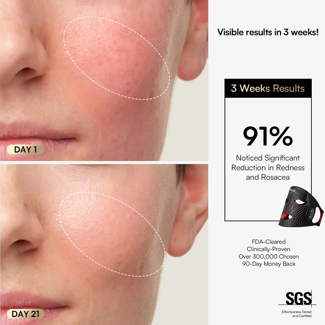 INIA GLOW Wireless Red Light Therapy Mask - Image 5