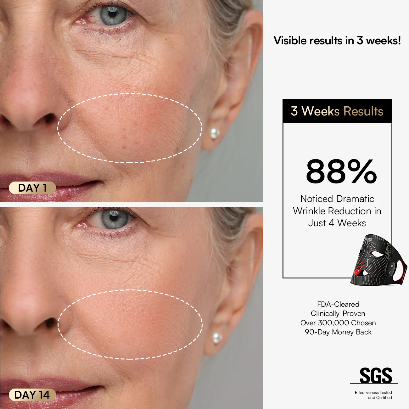 INIA GLOW Wireless Red Light Therapy Mask - Image 6
