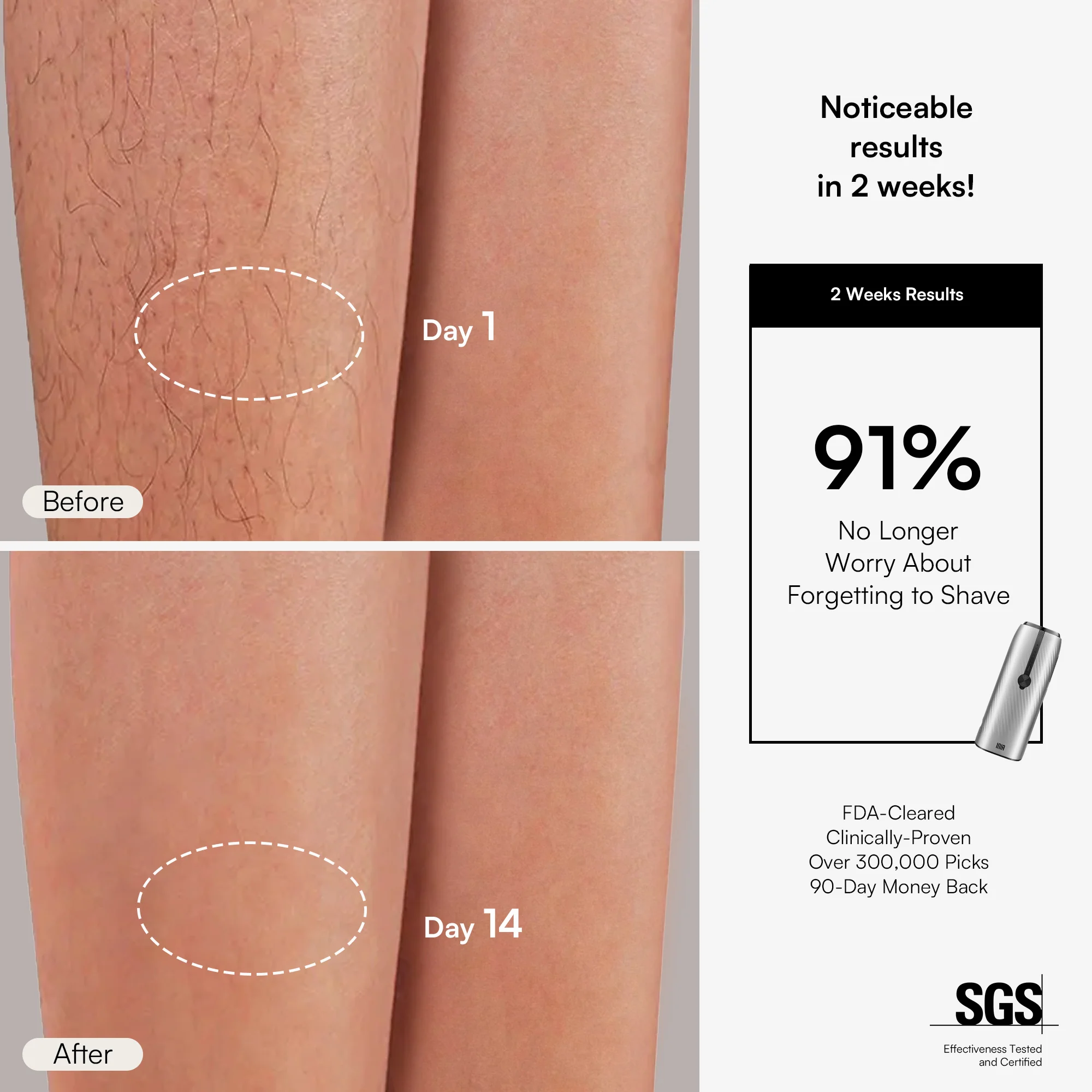 INIA HAUTE IPL Hair Removal Device - Image 5