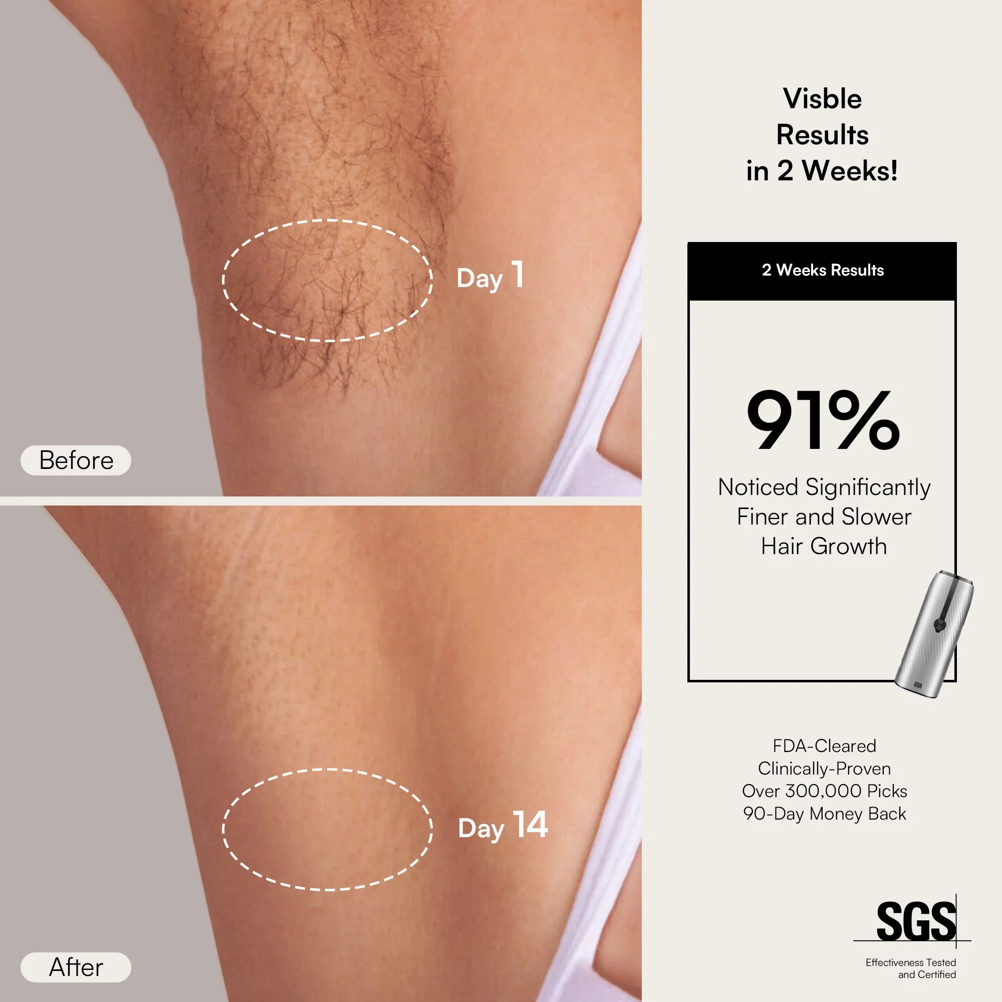 INIA HAUTE IPL Laser Hair Removal Device - Image 3
