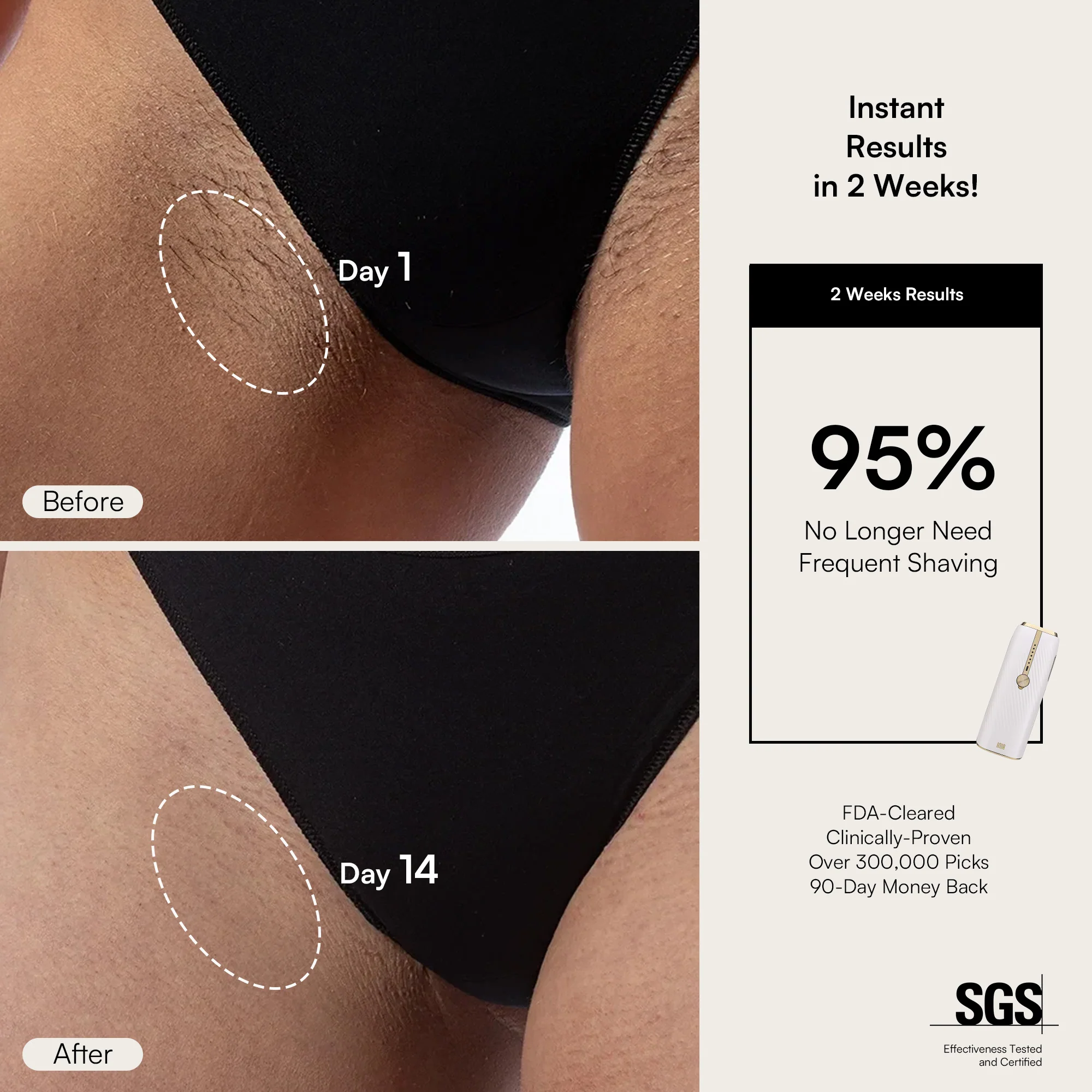 INIA HAUTE IPL Laser Hair Removal Device - Image 4