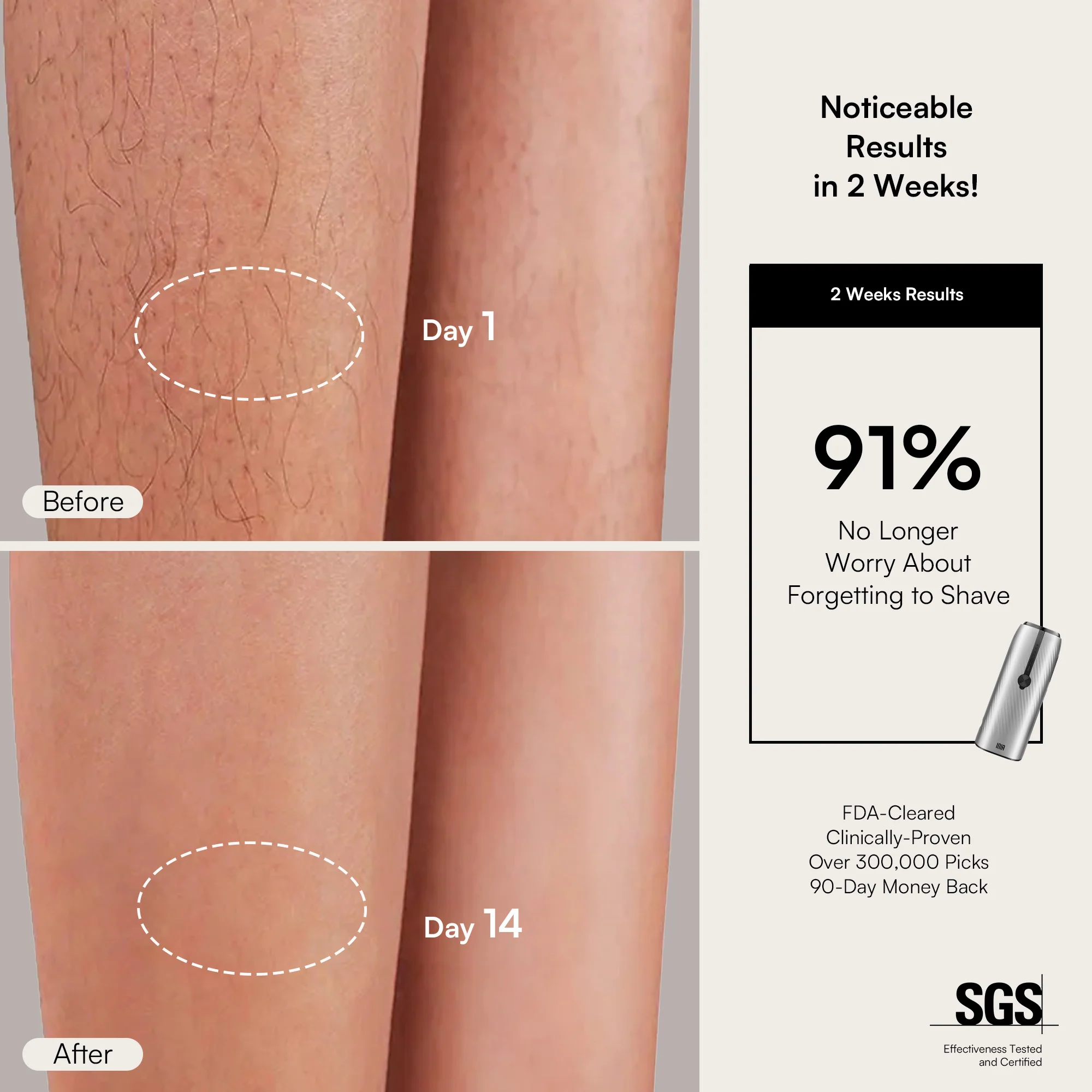 INIA HAUTE IPL Laser Hair Removal Device - Image 6