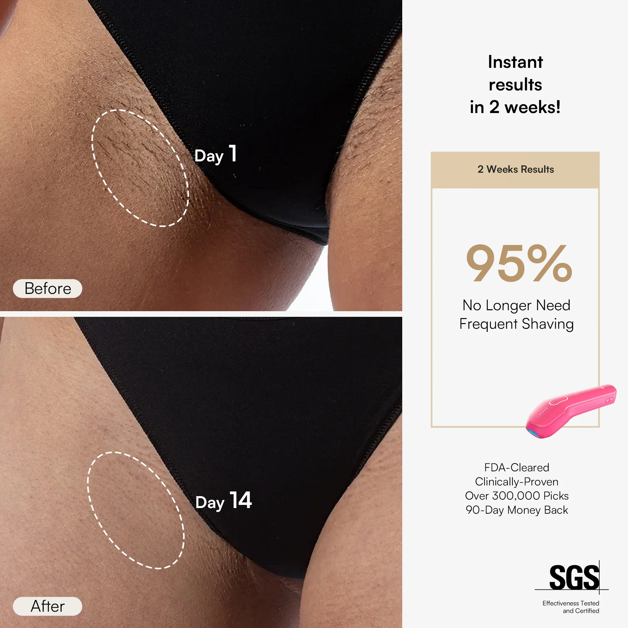 INIA HAUTE Pro IPL Hair Removal Device - Image 4