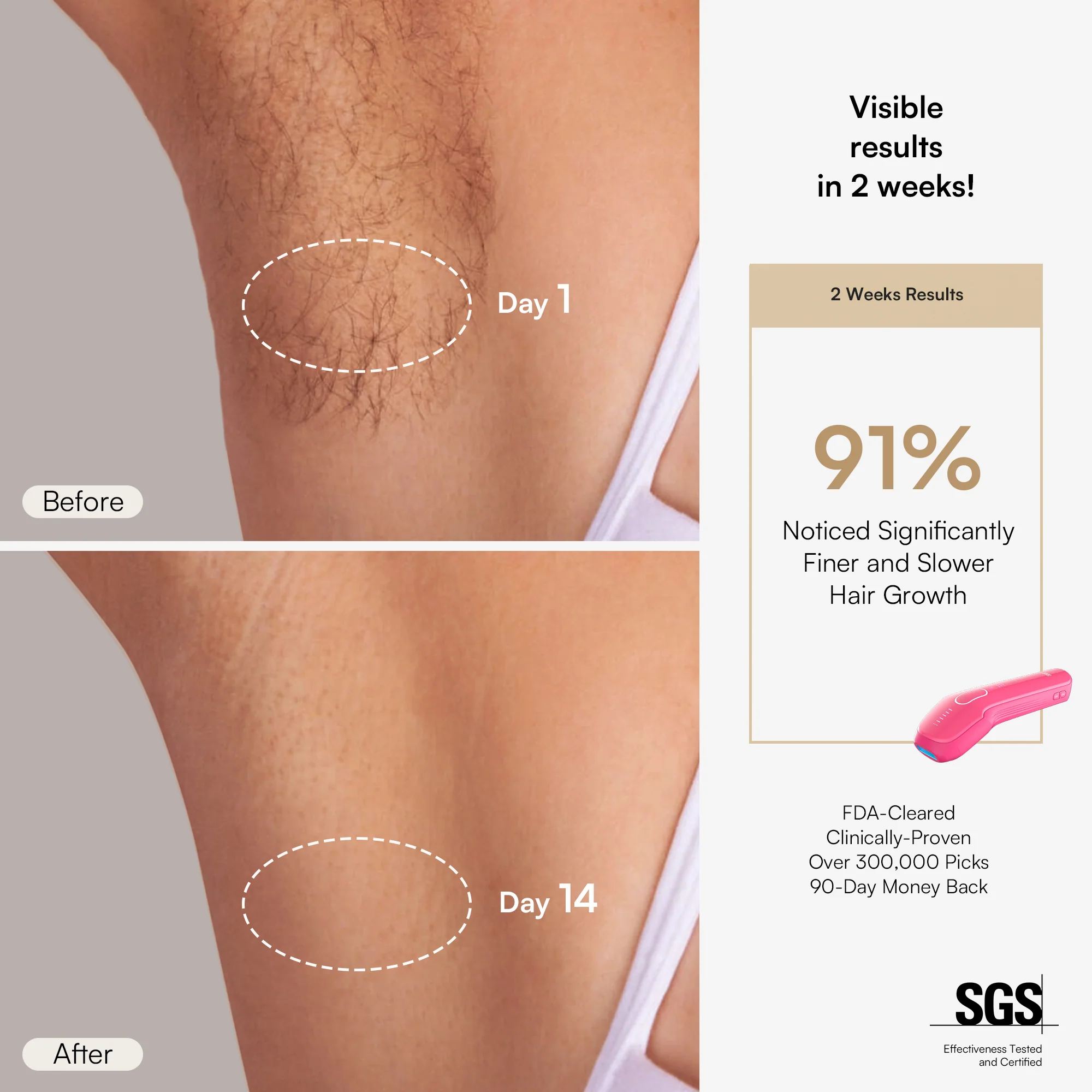INIA HAUTE Pro IPL Hair Removal Device - Image 5