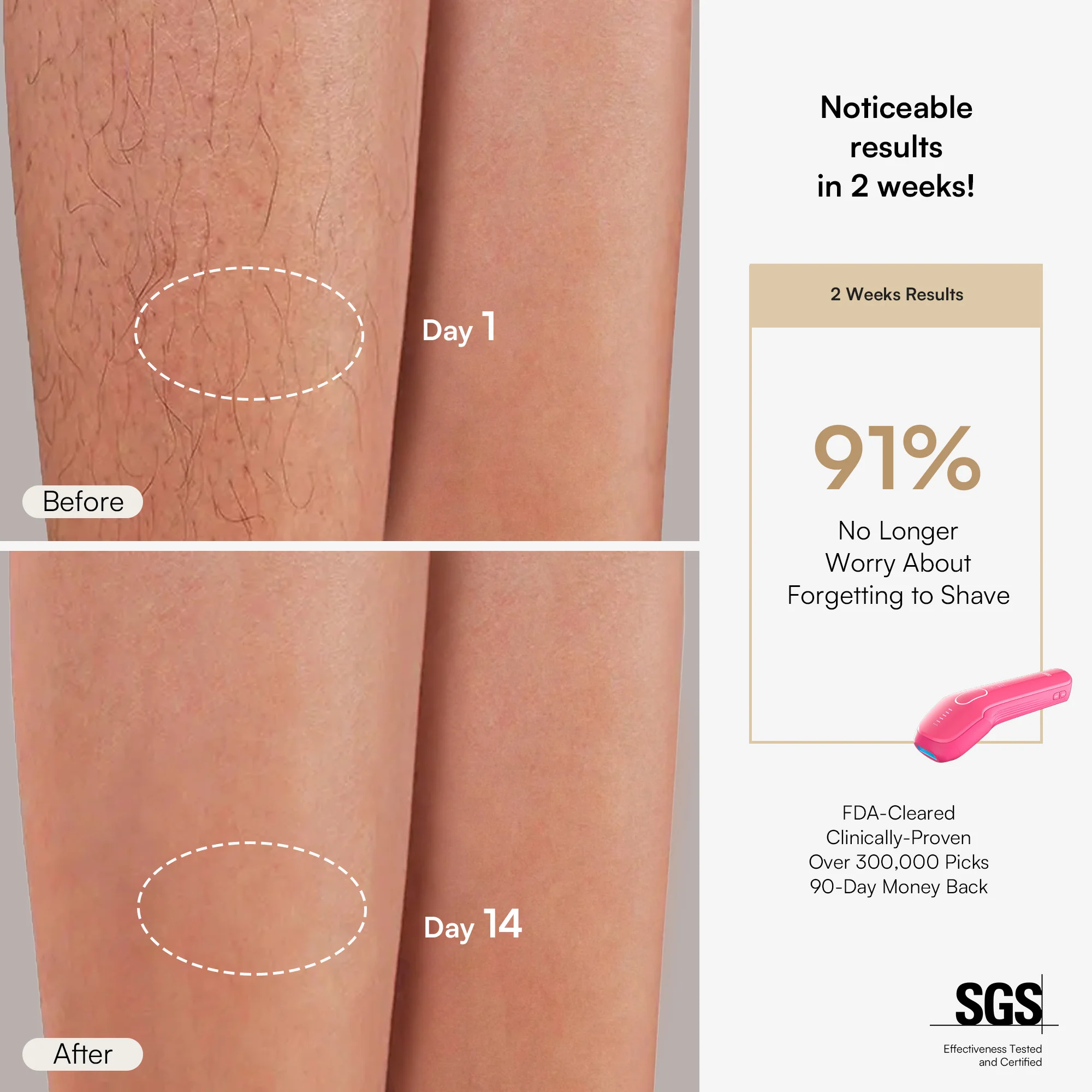 INIA HAUTE Pro IPL Hair Removal Device - Image 6