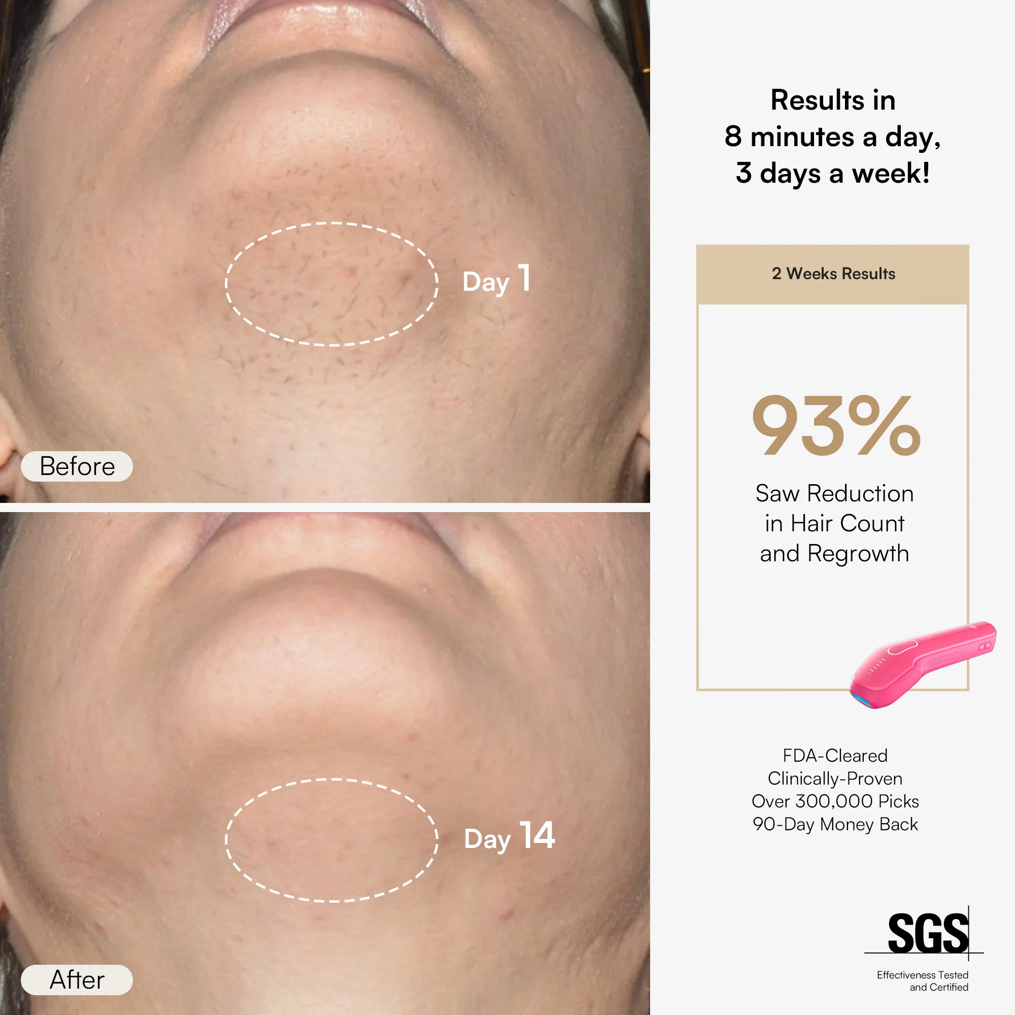 INIA HAUTE Pro IPL Hair Removal Device - Image 7