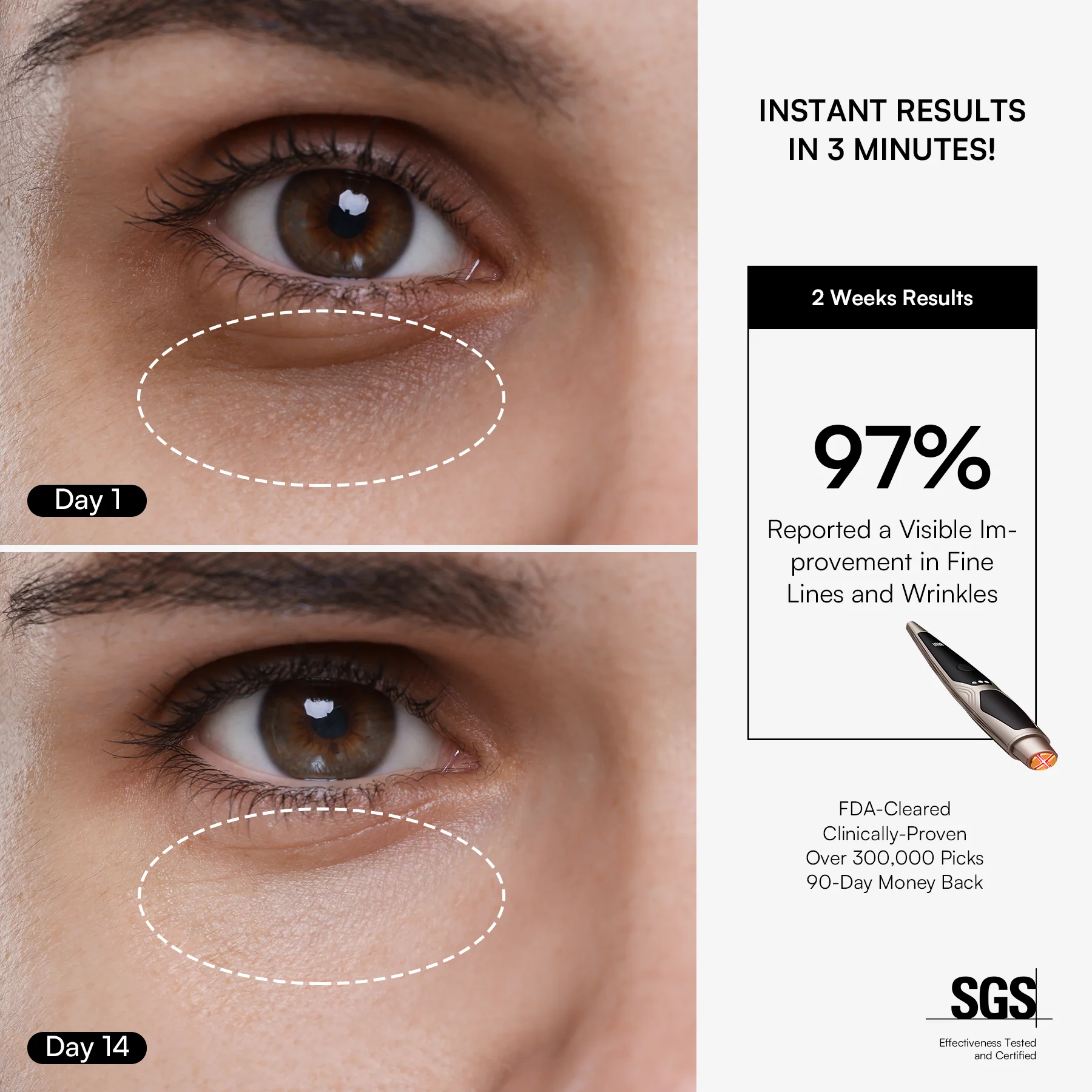 INIA LUMIN Eye Skincare Device - Image 3