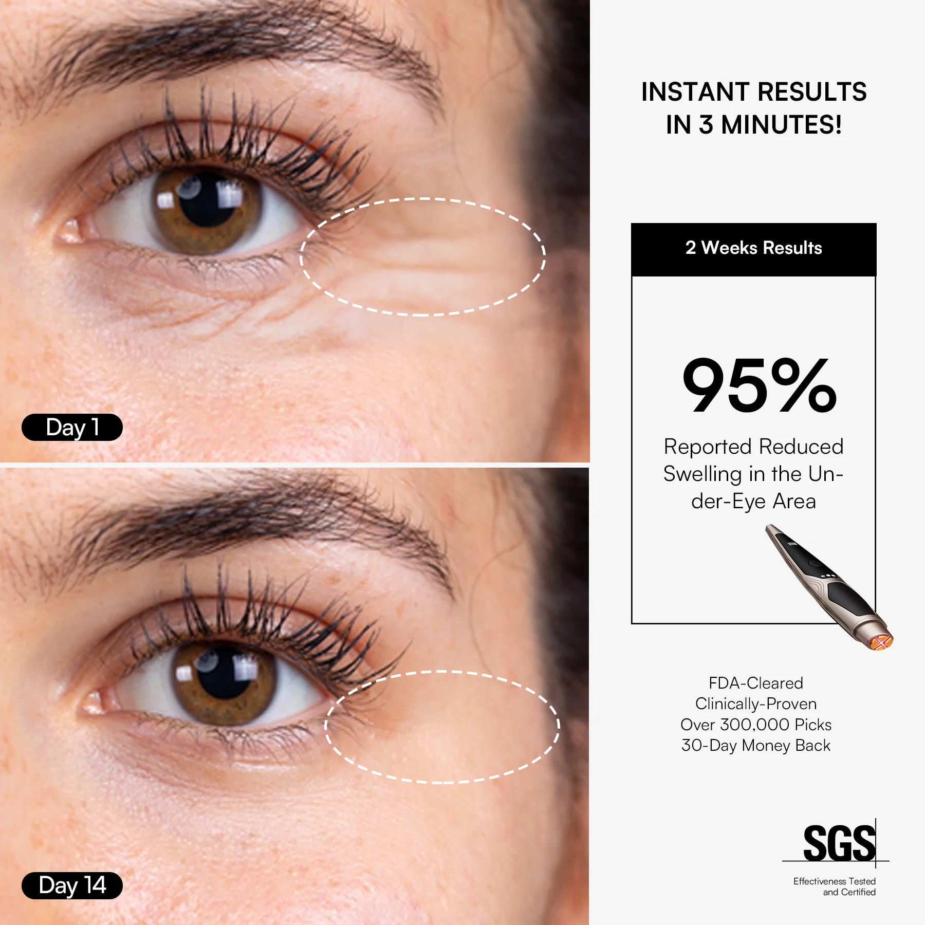INIA LUMIN Eye Skincare Device - Image 5