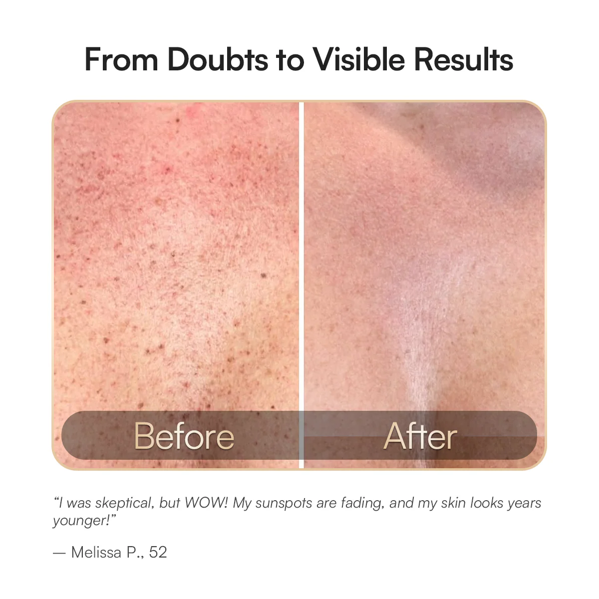 INIA GLOW Neck & Chest Red Light Therapy - Image 4