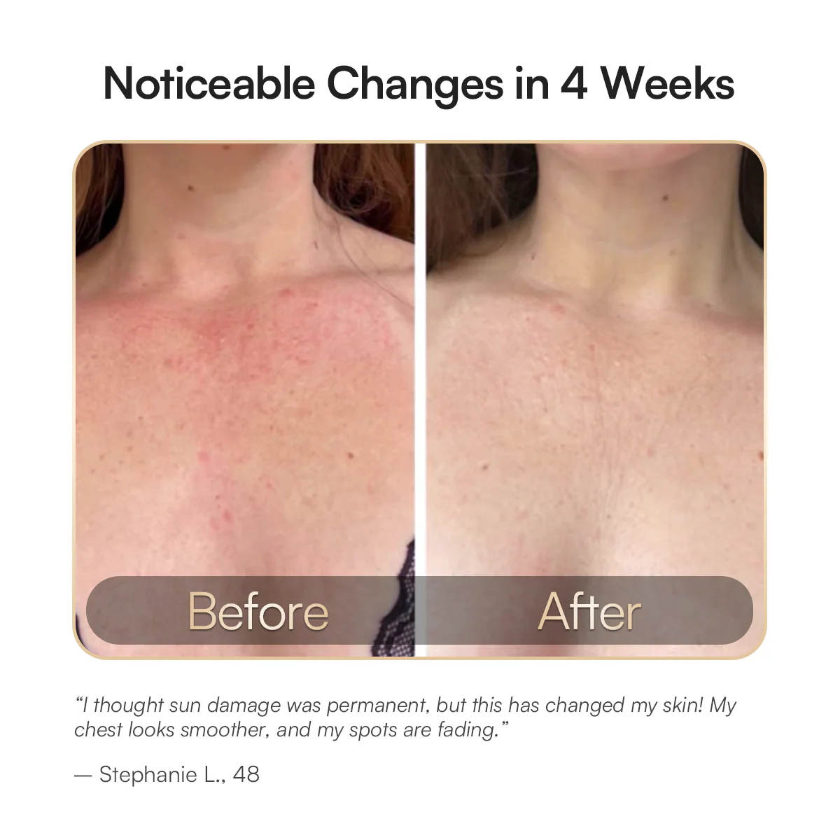 INIA GLOW Neck & Chest Red Light Therapy - Image 5