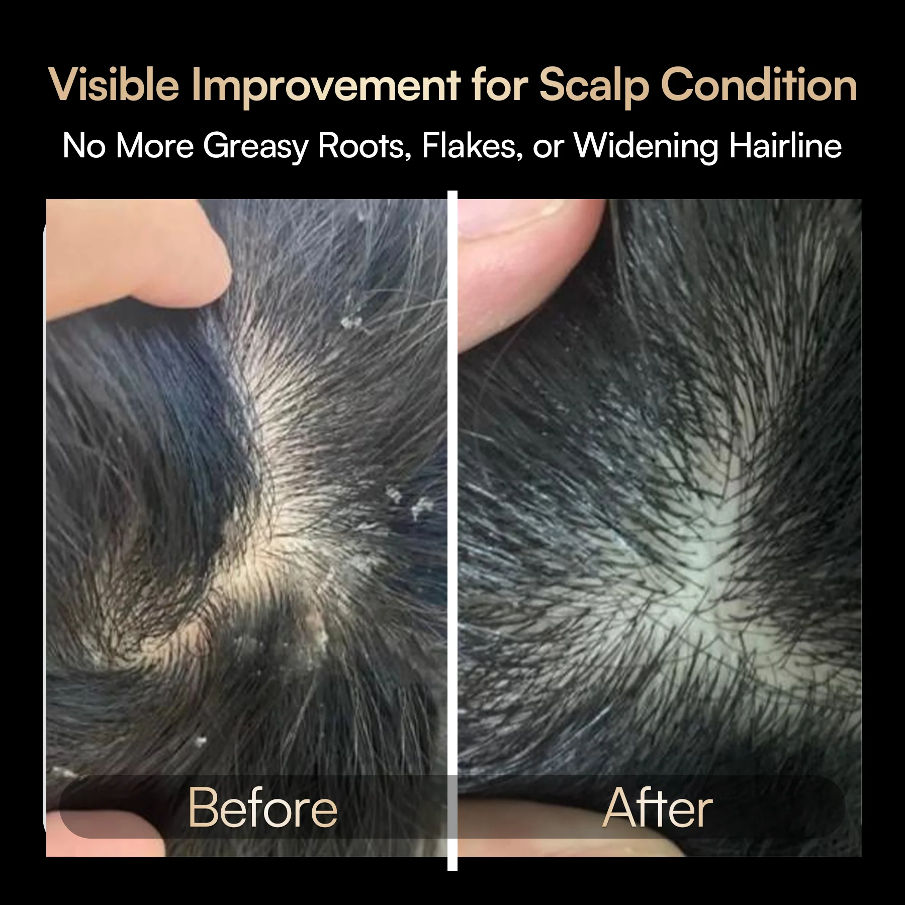 INIA VIBRA 4-in-1 Scalp Therapy Device - Image 3