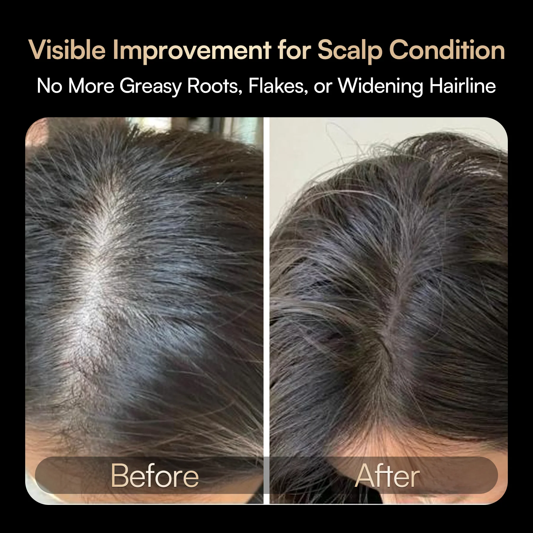 INIA VIBRA 4-in-1 Scalp Therapy Device - Image 4