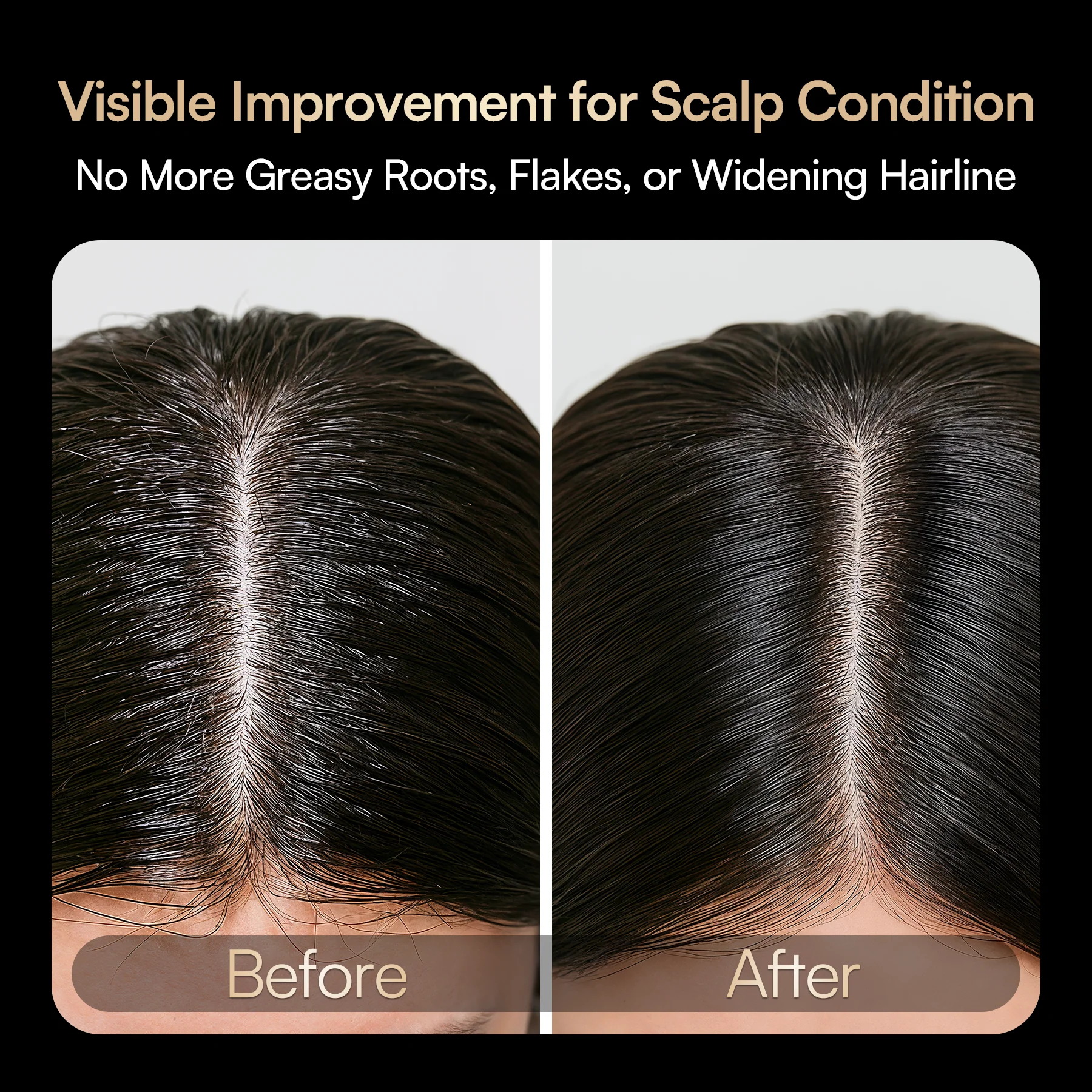 INIA VIBRA 4-in-1 Scalp Therapy Device - Image 5